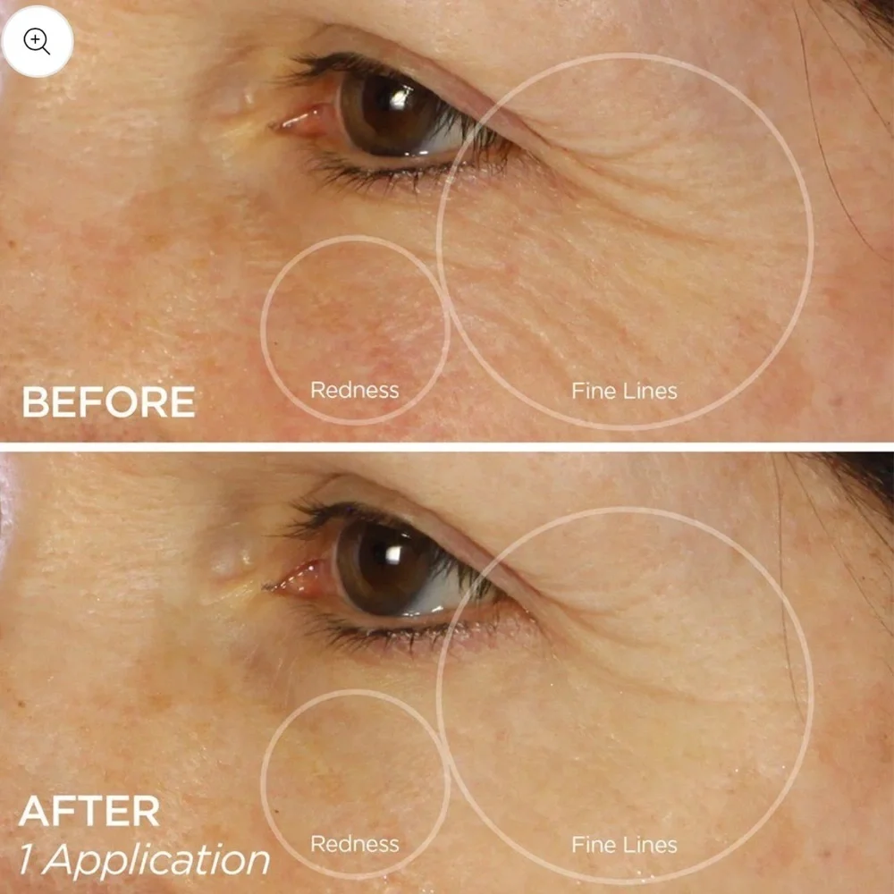 🌿 BeautyBio Bright Eyes DePuffing and Brightening Eye Gels